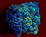 코로나 이어 에이즈도 mRNA 백신이 막는다