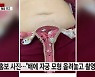 간호조무사 배에 침, 자궁 모형 놓고 '찰칵'..홍보한 한의사 논란