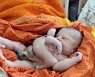 팔과 다리 4개 달린 아기 인도에서 태어났다, 가족은 "의사 고소하겠다"