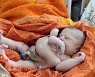 印서 팔·다리 4개인 아기 태어나..가족 "의사 고소하겠다"
