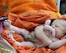 인도서 팔·다리 4개인 아기 탄생..'신의 화신' 불렸지만 부모는 의사 고소