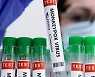 남아공 보건전문가 "원숭이두창 대량 백신접종 필요 없어"