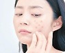 이성 앞도 아닌데 왜..툭하면 붉어지는 얼굴의 '불편한 진실'