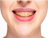 [건강톡톡] "이가 너무 누레요"..붙이는 치아미백제 효과 있을까