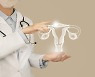 대표적인 여성 질환 '자궁근종'..치료 시기와 치료법은?