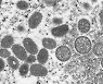 Africa Monkeypox