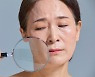 피부암은 겉으로 티가 난다? 흔한 오해 4