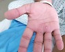 "침대 같이 썼을 뿐인데" 12일뒤 병원 가니 반려견이 당했다