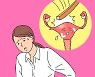 [건강in] 하루 1,616명 병원 찾는 '자궁근종' 예방·치료법은?