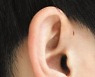귀 옆에 웬 '구멍'이.. 병원 가야 할까?