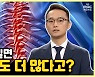 [약손+] 척추질환① 허리가 길면 허리뼈도 더 많다고?