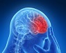 두통 심한데, 건강보험 되는 'MRI 검사' 받을 수 있나?