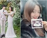 차쿤·송채윤, 결혼 한달만에 부모됐다 "새 생명 찾아와"