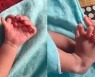 ‘손·발가락 26개’로 태어난 아기…“여신 재림” 인도 가족 환호