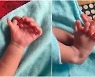 손·발가락 26개로 태어난 인도 아기…"여신의 재림" 기뻐한 가족