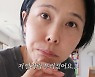 김나영 "아들 발에 부딪혀 발가락 골절…불난듯 아파"