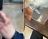 “봉투 안 준다고 폭행당해…치아 5개 깨졌다” 마트 사장의 토로